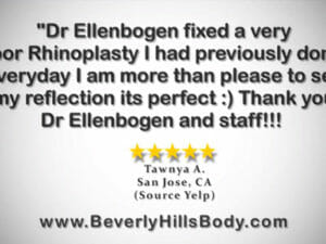 Beverly Hills Body Patient Reviews